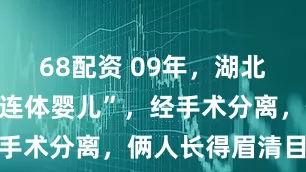 68配资 09年，湖北妈妈生下“连体婴儿”，经手术分离，俩人长得眉清目秀